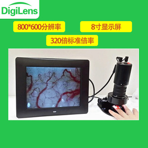 เครื่องตรวจจับการไหลเวียนโลหิตระดับไมโคร Godly Blood รุ่น DMX980-1 อุปกรณ์ถ่ายภาพเส้นเลือดฝอยบนเล็บระดับมืออาชีพ - Product Image 3