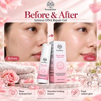 Crème Gel Réparatrice Apaisante Anti-Rougeurs pour Peaux Sensibles et Abîmées par les Stéroïdes, à base de PDRN Fermenté, d'ADN de Saumon, d'Oligopeptide-1 et d'Oligopeptide-3