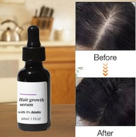 Sérum de croissance capillaire à la biotine 5% Formule à base de thé aux herbes Traitement anti-chute de cheveux Soin du cuir chevelu 60ml Marque privée OEM pour hommes et femmes