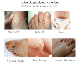 Benenลอกส้นเท้าPatch Care Tslm2 Oem Rose Hakken Verwijderen Dode Huidเล็บเท้าลอกผิวOntgiften Voetenหน้ากากผู้ใหญ่ - Product Image 3
