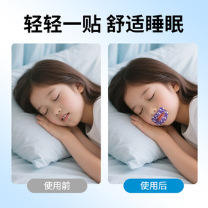 Patchs de Correction Respiratoire Bluesail+ 30 pièces Solution Anti-Ronflement pour Enfants - Product Image 3