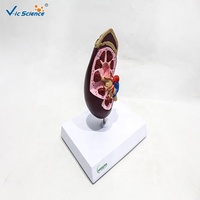 Modèle anatomique de rein humain démontable en PVC pour la néphrologie clinique et la démonstration pédagogique en anatomie CE/ISO/ROHS/CNAS