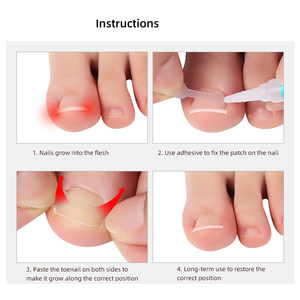 Tiras Correctoras para Uñas Encarnadas, Parche de Tratamiento para Uñas de los Pies, Corrector Adhesivo, Herramientas de Pedicura, Corrector de Uñas de los Pies - Product Image 4