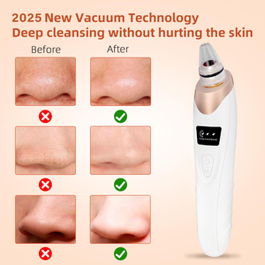 Physical Adsorption Facial Pore Vacuum Blackhead Remover <b>For</b> All Skin Types - Product Image 2