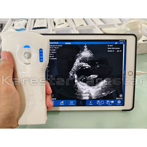 Ecógrafo Portátil Inalámbrico de Mano con 64 Canales, 192 Elementos, Wifi, 3 en 1, Color, para Animales - Product Image 5