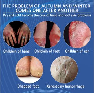 <span class=keywords><strong>Crema</strong></span> difesa tripla abbuffata alle erbe 18g per sollievo naturale del disagio cutaneo causato da stafilococco E.Coli & <span class=keywords><strong>Candida</strong></span> per uso alberghiero - Product Image 5