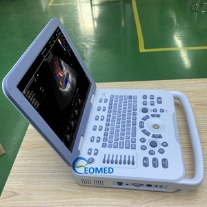 Échographe médical vétérinaire humain ergonomique, système Doppler couleur, clavier rétroéclairé et stockage de données puissant CU30-2 - Product Image 4