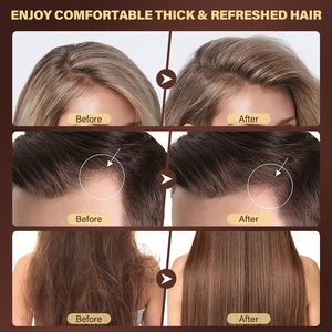 Champú Exfoliante 2 en 1 para el Crecimiento del Cabello con Aceite de Batana y Romero, Tratamiento para el Cuero Cabelludo, Exfoliante para <span class=keywords><strong>la</strong></span> <span class=keywords><strong>Caspa</strong></span>, Seco y con Picazón - Product Image 6