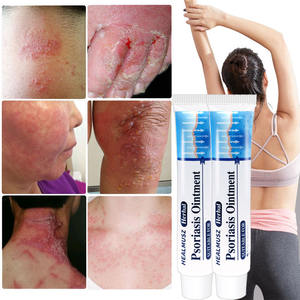 Ungüento antifúngico para eccema, extracción de hierbas chinas, dermatitis, psoriasis, ungüento, picazón, Peeling, cuidado de la salud - Product Image 3