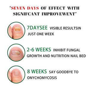7 jours de soin des ongles au gingembre gris réparation des ongles main pied soin des ongles hydratant crème réparatrice douce - Product Image 2