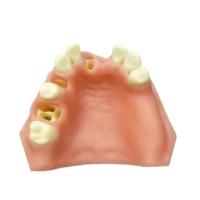 Modelo K de Implante Dental para Seno Maxilar y Dientes Faltantes - Herramienta de Entrenamiento Dental para Levantamiento de Seno y Práctica de Implantes