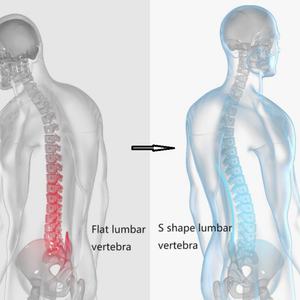 Almohadas 3D para la Cintura, Almohadas Cervicales Cómodas, Almohada para el Cuello con Relleno de Algodón PP y Cáscara de Trigo Sarraceno, Soporte Lumbar Desmontable - Product Image 6