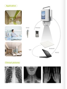 أفضل بيع معدات الأشعة السينية البيطرية المحمولة عالية التردد الإنسان وطبيب بيطري جهاز الأشعة السينية 5kw - Product Image 4