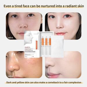 Masque Carbonaté à Vendre en 2025 Acide Carbonique CO2 Oxygène Nettoyage en Profondeur Carboxythérapie <span class=keywords><strong>Kit</strong></span> Masque au Gel CO2 + Gel CO2 - Product Image 3