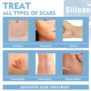 카부 울트라 씬 통기성 흉터 제거 편안하고 통증 없는 재사용 가능 세척 가능 부드러운 흉터 시트 실리콘 테이프 상처 패치 - Product Image 5