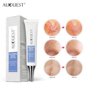 Loại bỏ mụn Kem sửa chữa Gel vết rạn da gel desalt mặt nhanh chóng và hiệu quả không có tác dụng phụ Kem Trị Mụn - Product Image 2