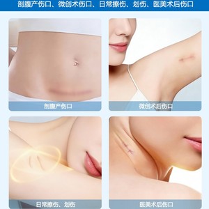 Postpartum Recovery Patch Disposable Sutureless Closure Device For Epidermal Non Invasive Suturing - Product Image 2