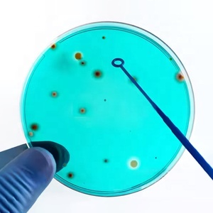 Anillo de Inoculación de Plástico Desechable, Esterilizado, para Laboratorio Bacteriológico, Herramienta de Microbiología, 10 cm de Longitud, de Un Solo Uso - Product Image 1