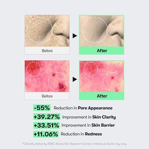 VT CICA Reedle Shot 100 Siero 50ml per Microneedling, Cura dei Pori, Esfoliante per la Cura della Pelle del Viso - Product Image 6