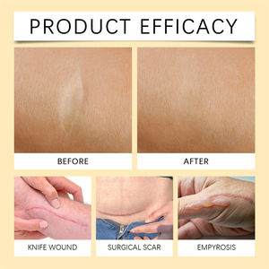 Ximonth Bienen gift Narben pflege <span class=keywords><strong>Spray</strong></span> Messer Wunde chirurgische Narbe Heilung Empyrose Linderung Glättung aufhellende Feuchtigkeit creme <span class=keywords><strong>Spray</strong></span> - Product Image 6