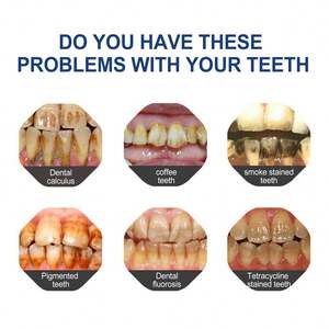 JAYSUING Nouvelle Arrivée Blanchiment Dentaire Temporaire <span class=keywords><strong>Peinture</strong></span> Dentaire Personnalisée Marque JAYSUING - Product Image 6