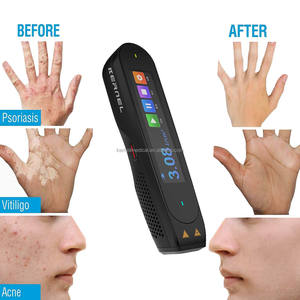 เครื่องฉายแสงยูวีสำหรับโรคด่างขาวและสะเก็ดเงิน รุ่นพกพา CN-308P 308nm ปากกาเอ็กไซเมอร์ขนาดเล็ก กำลังสูง - Product Image 2