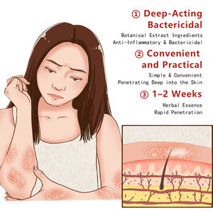 ครีมเจลสมุนไพรบรรเทาอาการคัน ขายดี สำหรับปัญหาผิวหนัง เช่น รอยแดง <span class=keywords><strong>บวม</strong></span> คัน และสะเก็ดเงิน - Product Image 2
