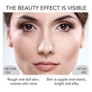 صابون كافيار LKIAE الفاخر 120 جرام، صابون استحمام يدوي الصنع بالحليب وحبوب الأرز، منظف لطيف ومرطب ومفتح للبشرة - Product Image 6