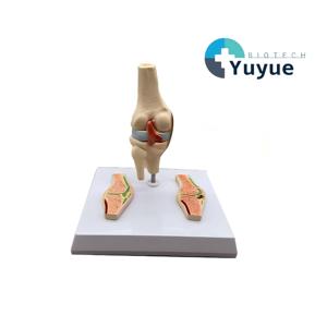 Modelo de Articulación de Rodilla con Artritis Reumatoide - Herramienta Educativa de <span class=keywords><strong>Ortopedia</strong></span> - Product Image 1