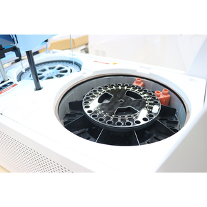 Sistema de Análisis Bioquímico Mecanmed, Analizador Químico Humano, Analizador Bioquímico Completamente Automático - Product Image 2