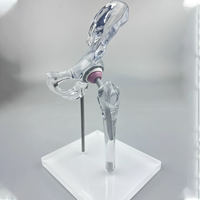 Modèle transparent d'implant de joint de hanche, modèle de remplacement, taille mini, modèle de présentation générique transparent
