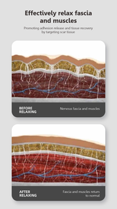 Appareil de Récupération Sportive à Haute Fréquence et Vibration Rapide pour le Soulagement Complet des Douleurs Corporelles - Product Image 3