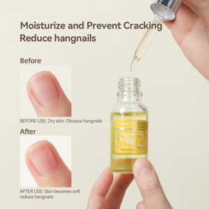 Vinimay Organic Nail Care Cuticle <strong>Oil</strong> 14 Flavors 20ml Custom Logo Nail Cuticle <strong>Oil</strong> Dry and Non-greasy Cuticle <strong>Oil</strong> for Nails - Product Image 4