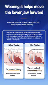 Protège-dents moulables Protège-dents en silicone pour bruxisme Protège-dents en silicone Meilleur protège-dents pour repos de nuit Kit protège-dents anti-ronflement - Product Image 6
