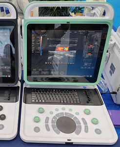 Compatto 3D/4D computer portatile a colori Doppler sistema ad ultrasuoni ideale per la gravidanza di scansione in cliniche e ospedali - Product Image 3