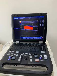 Appareil d'échographie cardiaque <span class=keywords><strong>portable</strong></span> CE, échographie 2D, échographie cardiaque 3D, échographie <span class=keywords><strong>Doppler</strong></span> couleur - Product Image 2