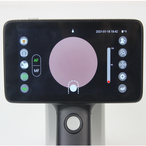 Cámara de fondo de ojo digital NFC portátil, automatizada y no miopatizante, precio para uso en humanos y animales - Product Image 2