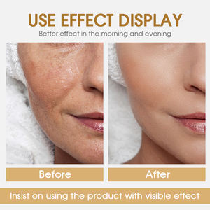 Crema di merlano al collagene lumaca più venduta per lo sbiancamento del viso crema naturale per il viso e lozione - Product Image 5