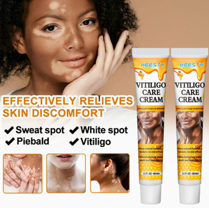 Ungüento para Eliminar Efectivamente el Vitiligo, Elimina la Tiña y las Manchas Blancas, Producto para el Cuidado de la Piel con Vitiligo - Product Image 1