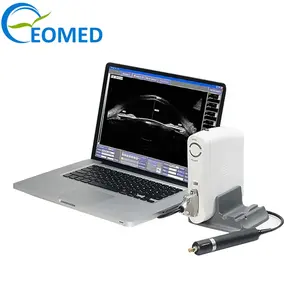 UBM3200S 저렴한 가격 임상 안과 휴대용 초음파 눈 부상 및 섬 모체를위한 바이오 현미경 UBM 기계