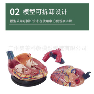 Modèle de cœur humain agrandi 5 fois, échographie Doppler couleur, modèle d'anatomie cardiaque, modèle de valve endocardeenne. - Product Image 4