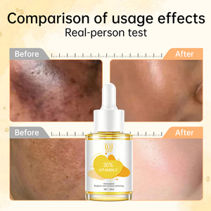 Siero Avanzato alla Vitamina C con Ialuronato di Sodio e Niacinamide 30ml, Riduce Segni dell'<span class=keywords><strong>Acne</strong></span> e Macchie Scure, Idratante, Sbiancante, Riparatore della Pelle - Product Image 5