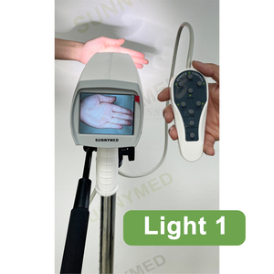 Bệnh viện video kỹ thuật số soi cổ tử cung cho phụ nữ kiểm tra cổ tử cung - Product Image 1