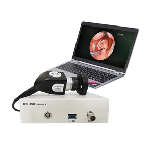 Ekonomik ve pratik standart yeniden video laringoskop 700 satır tıbbi endoscopi seti sert endoskop kamera - Product Image 5