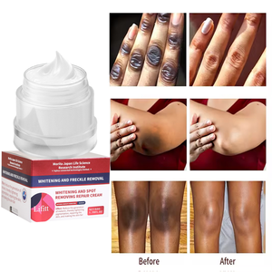 Gesichtscreme mit Niacinamid zur Entfernung von Dunklen Flecken, Tiefenwirksame Pflege, Natürliche Schönheitspflege, Feuchtigkeitsspendende Gesichtscreme - Product Image 3