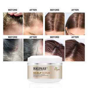 RiginasPrivate Label minyak Rosemary kulit kepala kulit kepala krim pengobatan pengelupasan & <span class=keywords><strong>Psoriasis</strong></span> - Product Image 5