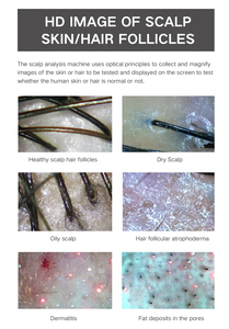 2026 New Ai Scalp Skin Analysis Beauty Device Anti Hair Loss Hair Regrowth Treatment Scalp Analysis Machine UV 3 Color Light - Product Image 5