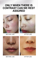 Crème anti-taches noires coréenne crème blanchissante au glutathion à la vitamine C pour le visage