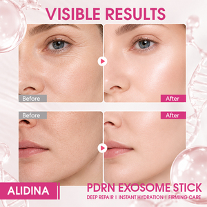 Baume multi-usages <span class=keywords><strong>M</strong></span> Skin Care PDRN <span class=keywords><strong>Exo</strong></span> Repair Stick, raffermissant, repulpant, hydratation instantanée, baume barrière avec complexe de peptides de collagène OEM - Product Image 4
