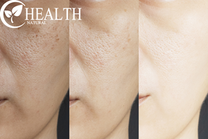 Palmitate d'ascorbyle pur de qualité cosmétique, fourni par l'usine, pour les soins de la peau, <span class=keywords><strong>acide</strong></span> L-<span class=keywords><strong>ascorbique</strong></span> 6-hexadécanoate CAS 137-66-6 - Product Image 4